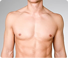 torso desnudo de chavo despues de una cirugia de reduccion de pecho